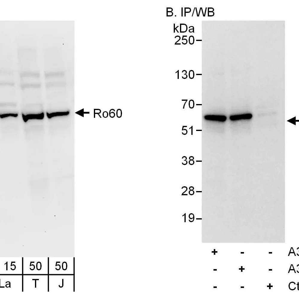 Rabbit anti-Ro60 Antibody, Affinity Purified