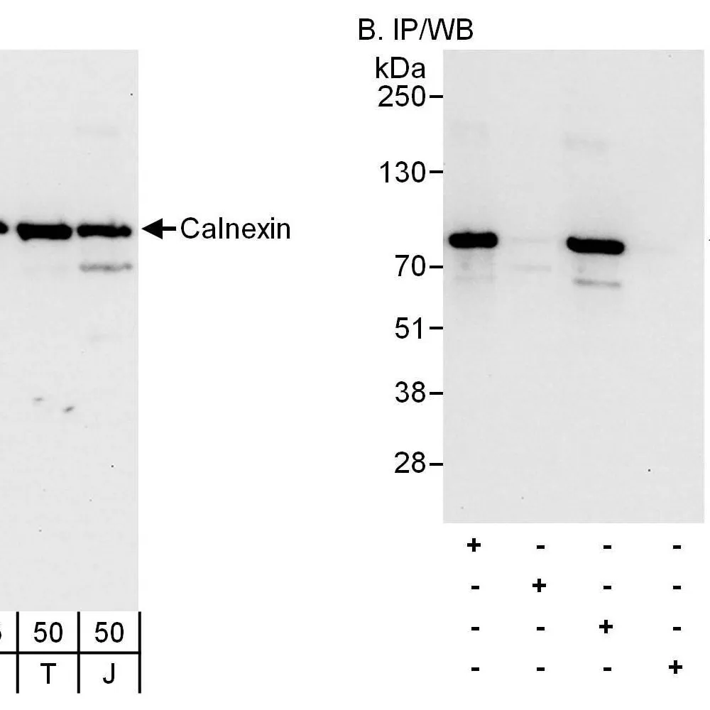 Rabbit anti-Calnexin Antibody, Affinity Purified