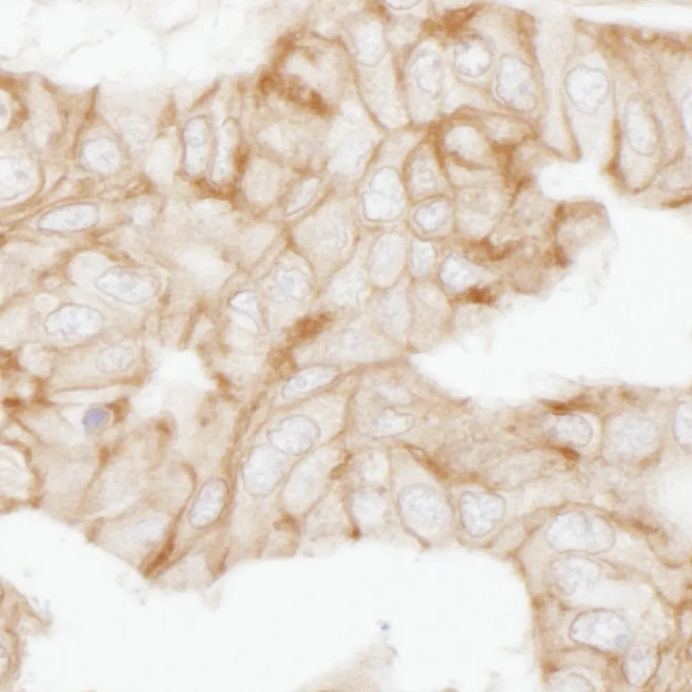 Rabbit anti-Alpha-Adducin Antibody, Affinity Purified