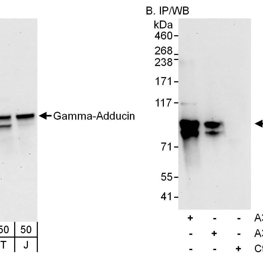 Rabbit anti-Gamma-Adducin Antibody, Affinity Purified