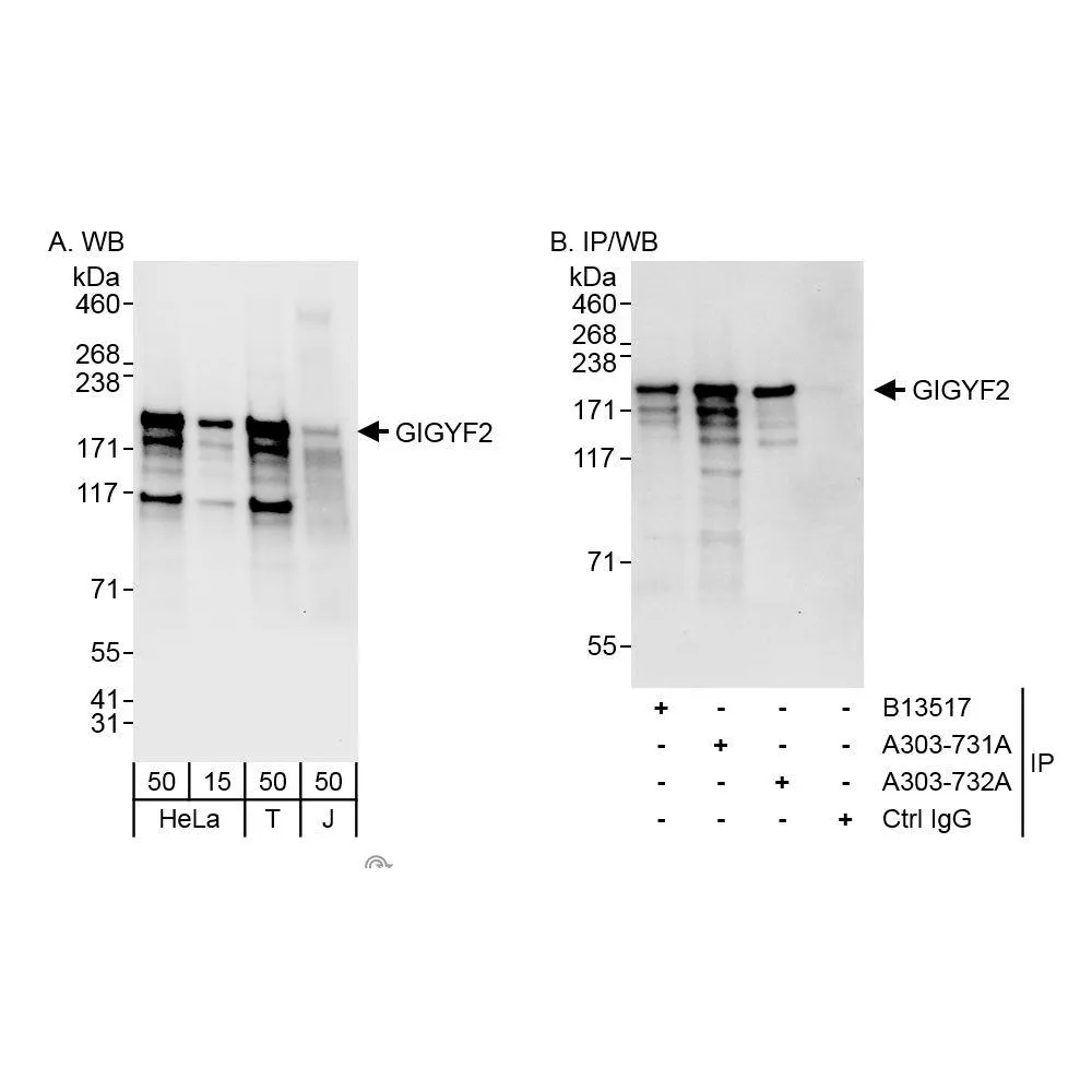Rabbit anti-GIGYF2 Antibody, Affinity Purified