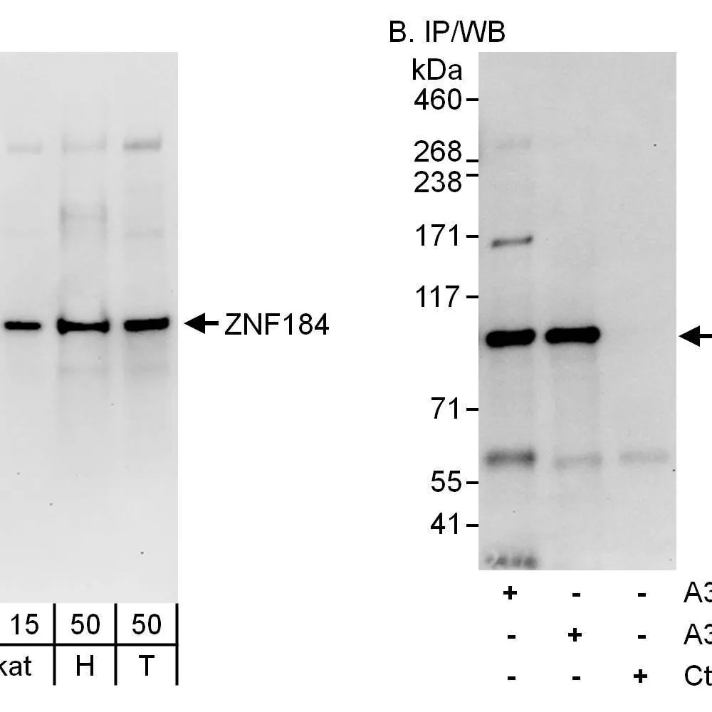 Rabbit anti-ZNF184 Antibody, Affinity Purified