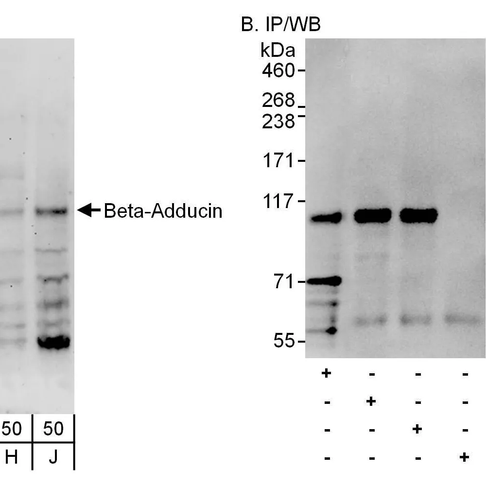 Rabbit anti-Beta-Adducin Antibody, Affinity Purified