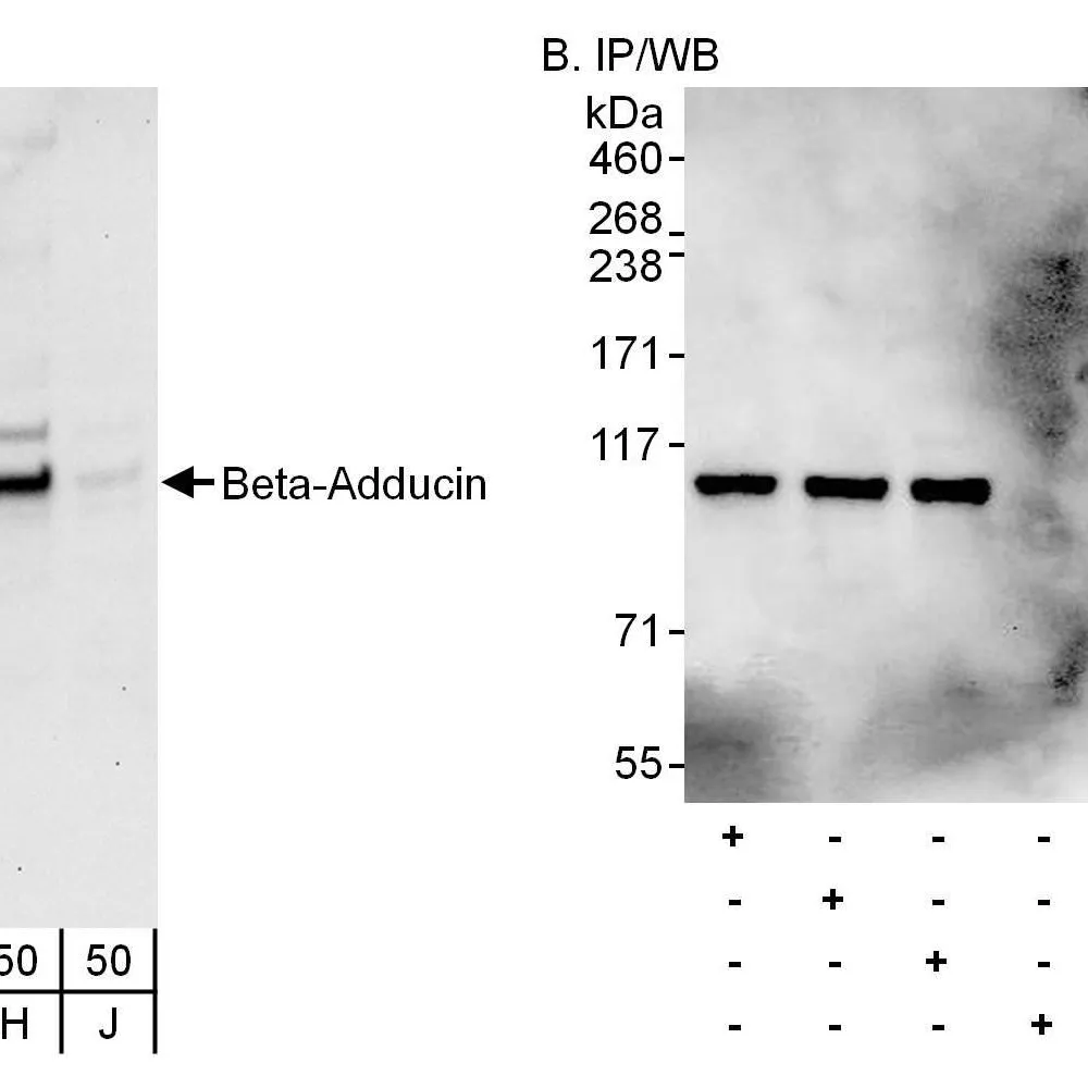 Rabbit anti-Beta-Adducin Antibody, Affinity Purified