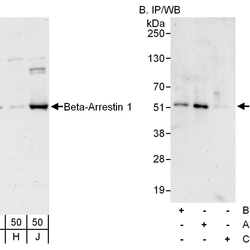 Rabbit anti-Beta-Arrestin 1 Antibody, Affinity Purified
