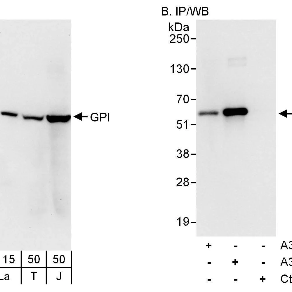 Rabbit anti-GPI Antibody, Affinity Purified