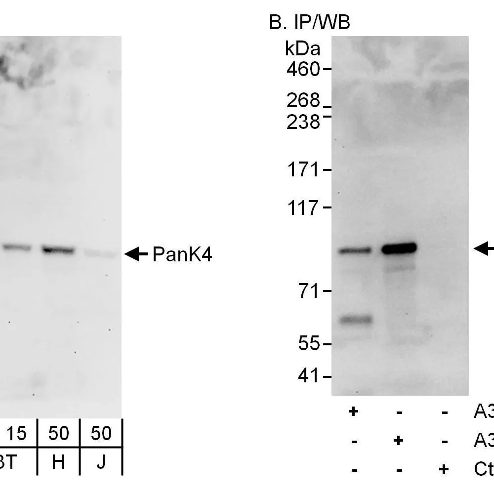 Rabbit anti-PanK4 Antibody, Affinity Purified