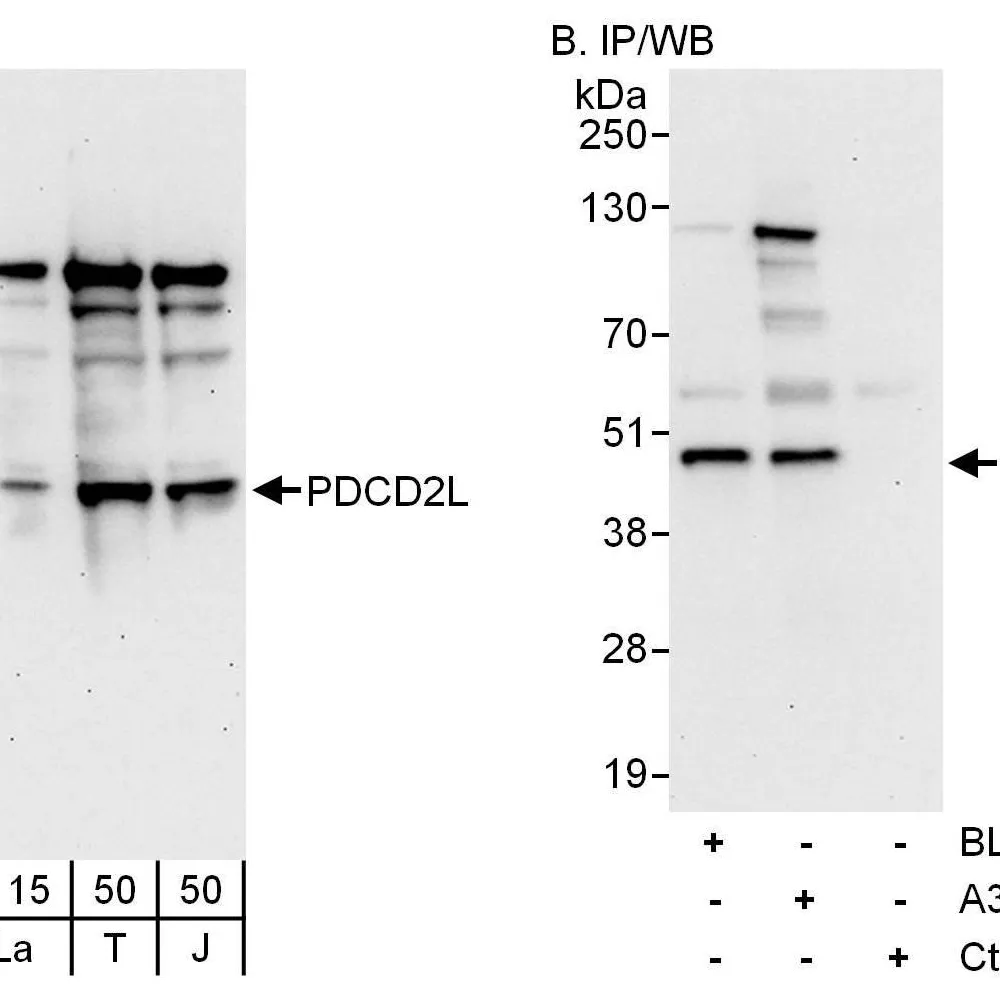 Rabbit anti-PDCD2L Antibody, Affinity Purified