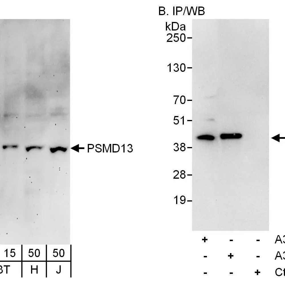 Rabbit anti-PSMD13 Antibody, Affinity Purified