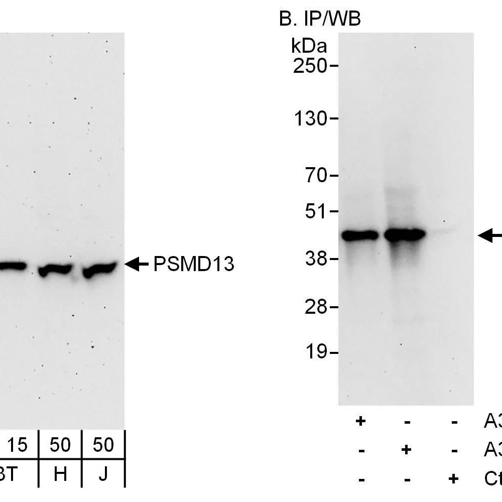 Rabbit anti-PSMD13 Antibody, Affinity Purified