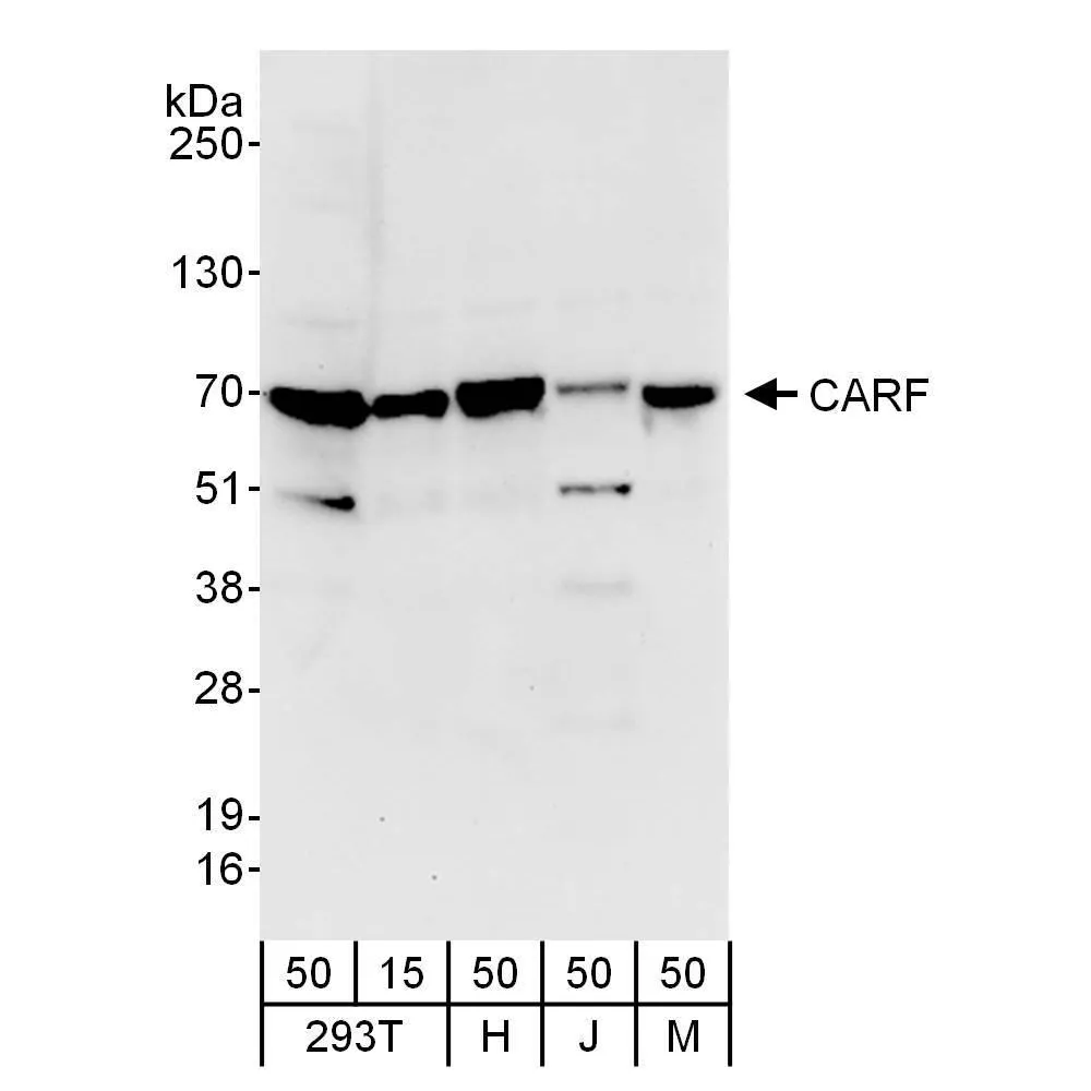 Rabbit anti-CARF Antibody, Affinity Purified