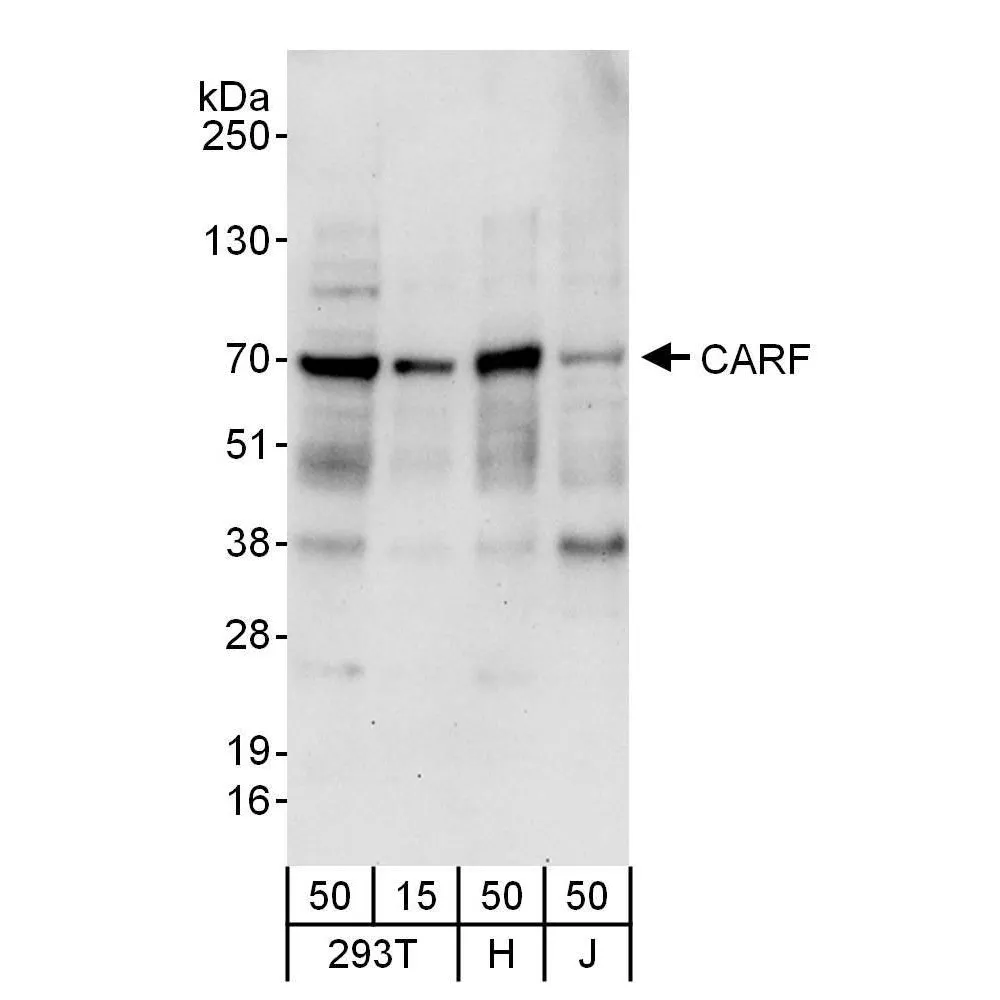 Rabbit anti-CARF Antibody, Affinity Purified