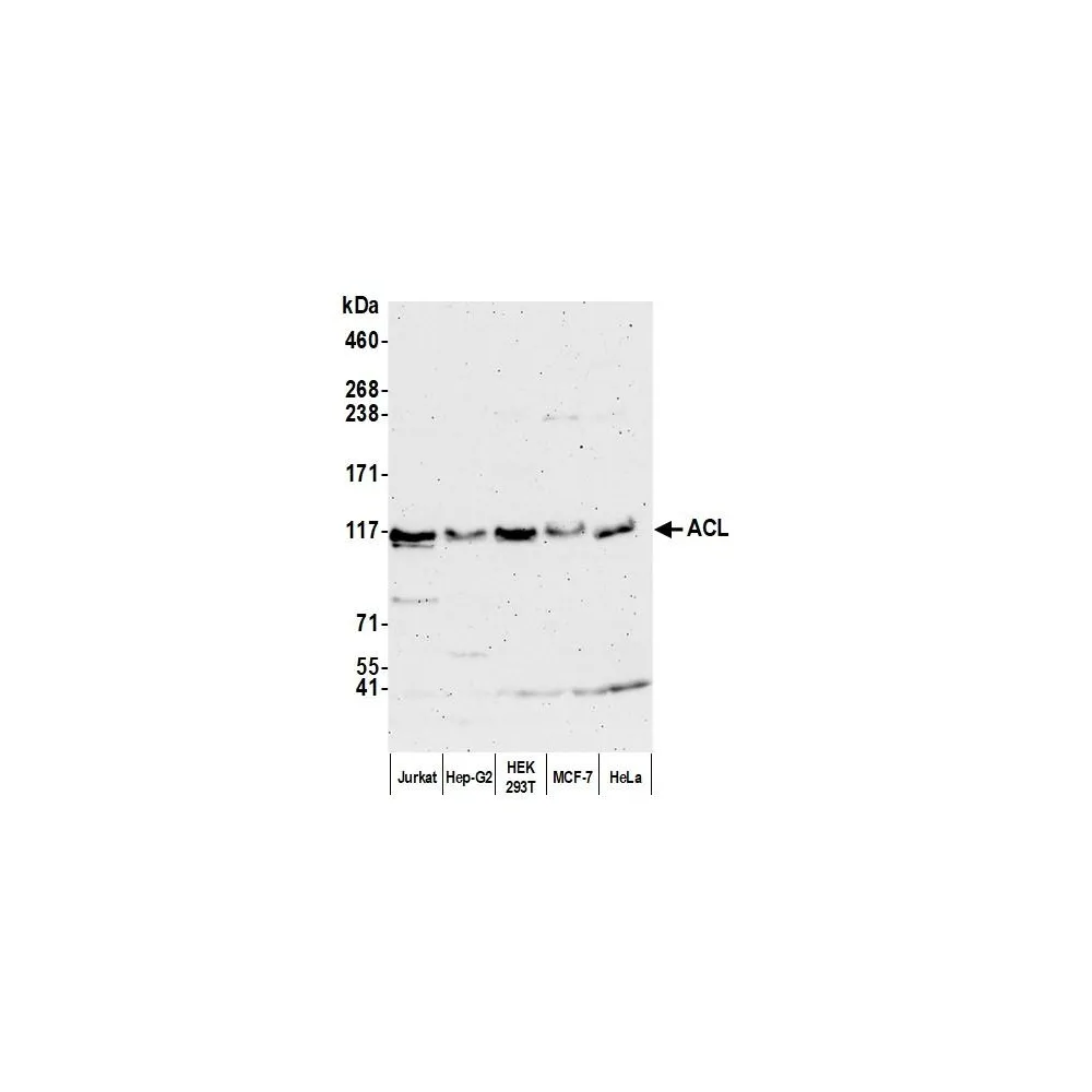 Rabbit anti-ACL Antibody, Affinity Purified