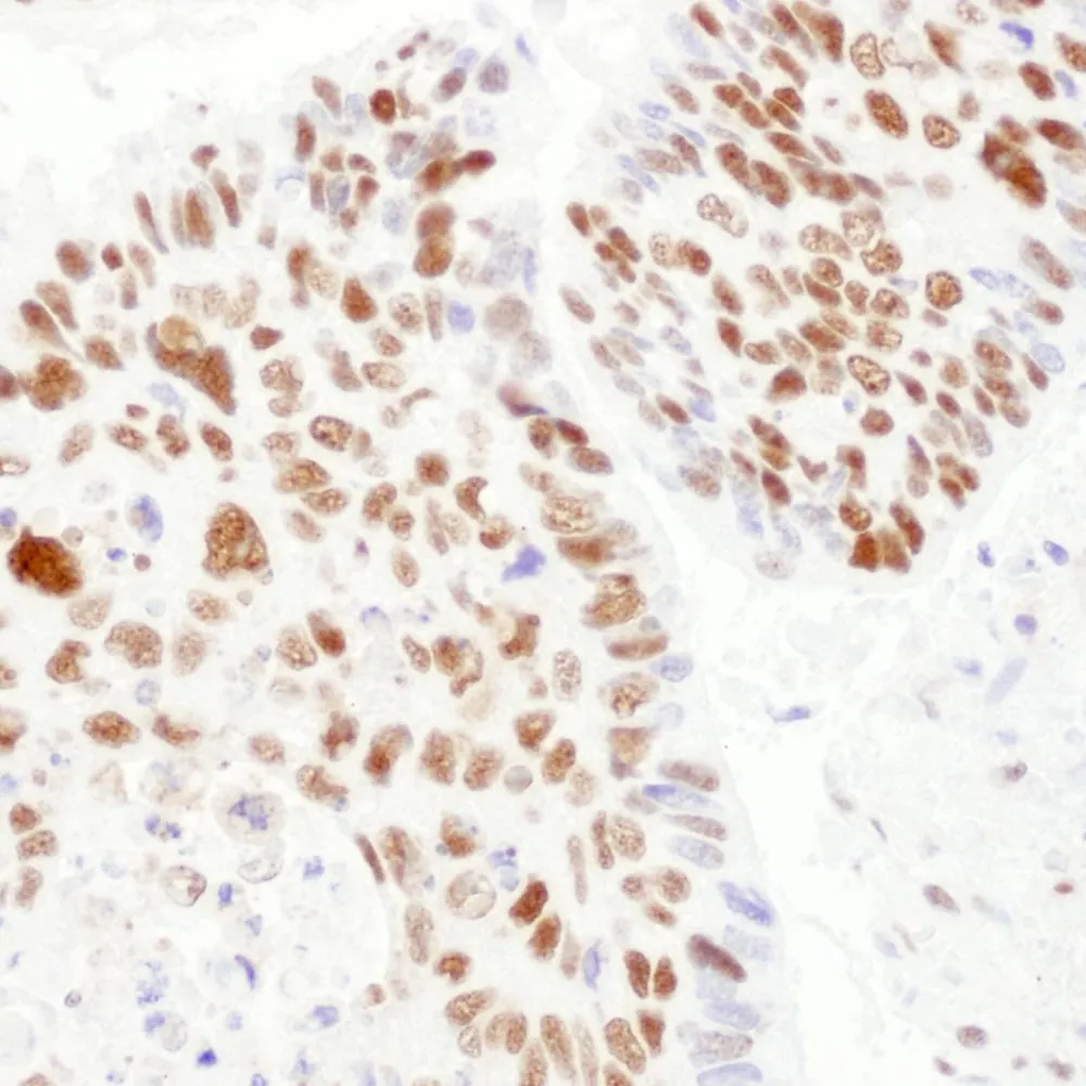 Rabbit anti-PSME3 Antibody, Affinity Purified