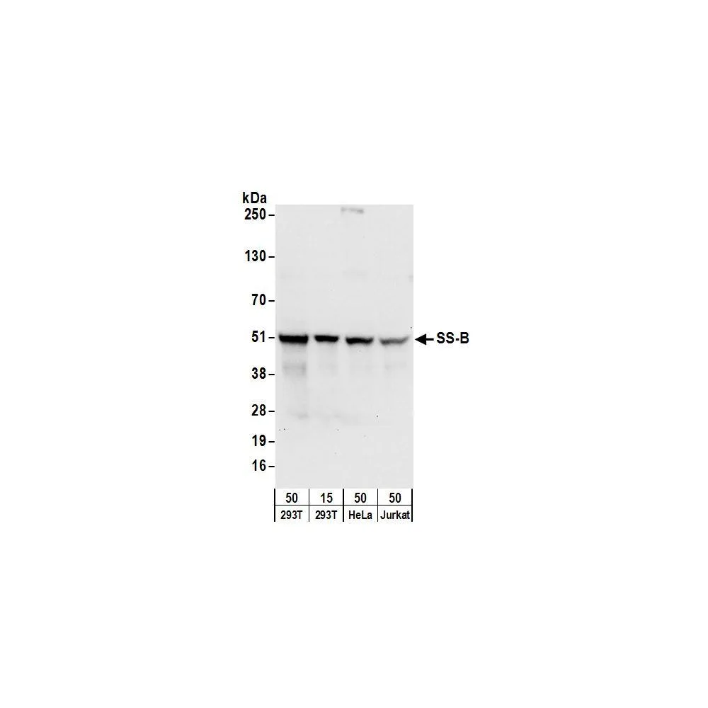 Rabbit anti-SS-B Antibody, Affinity Purified