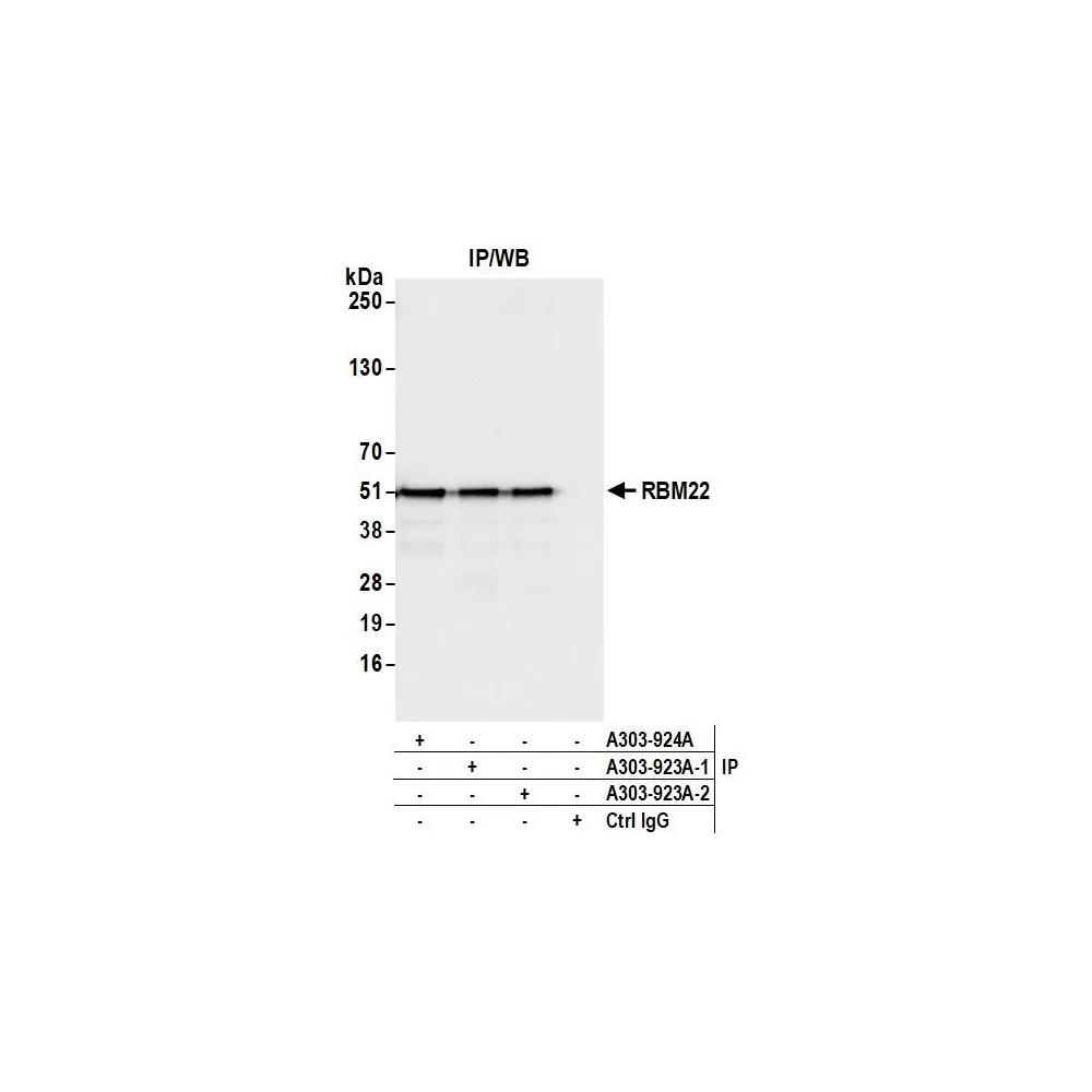 Rabbit anti-RBM22 Antibody, Affinity Purified
