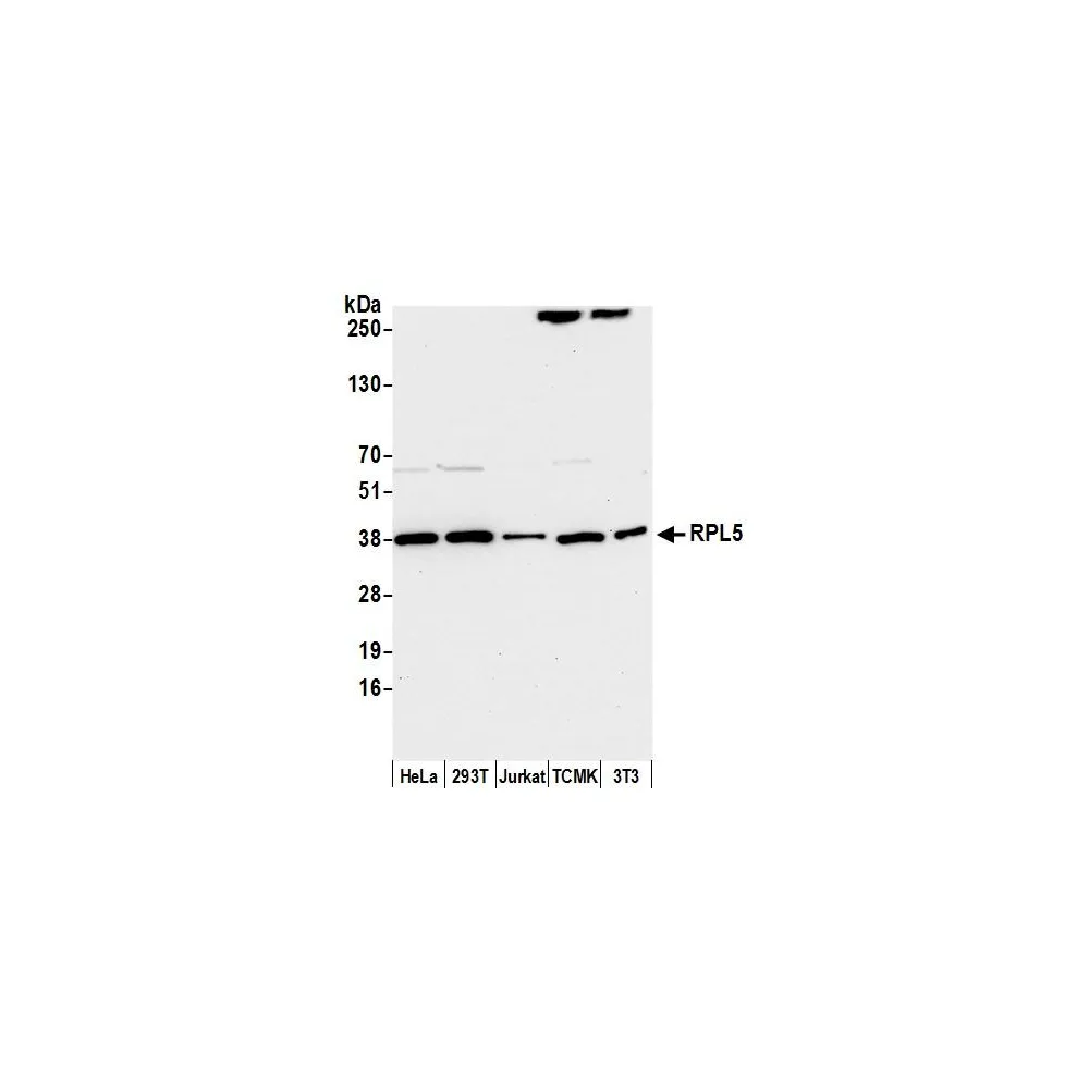 Rabbit anti-RPL5 Antibody, Affinity Purified