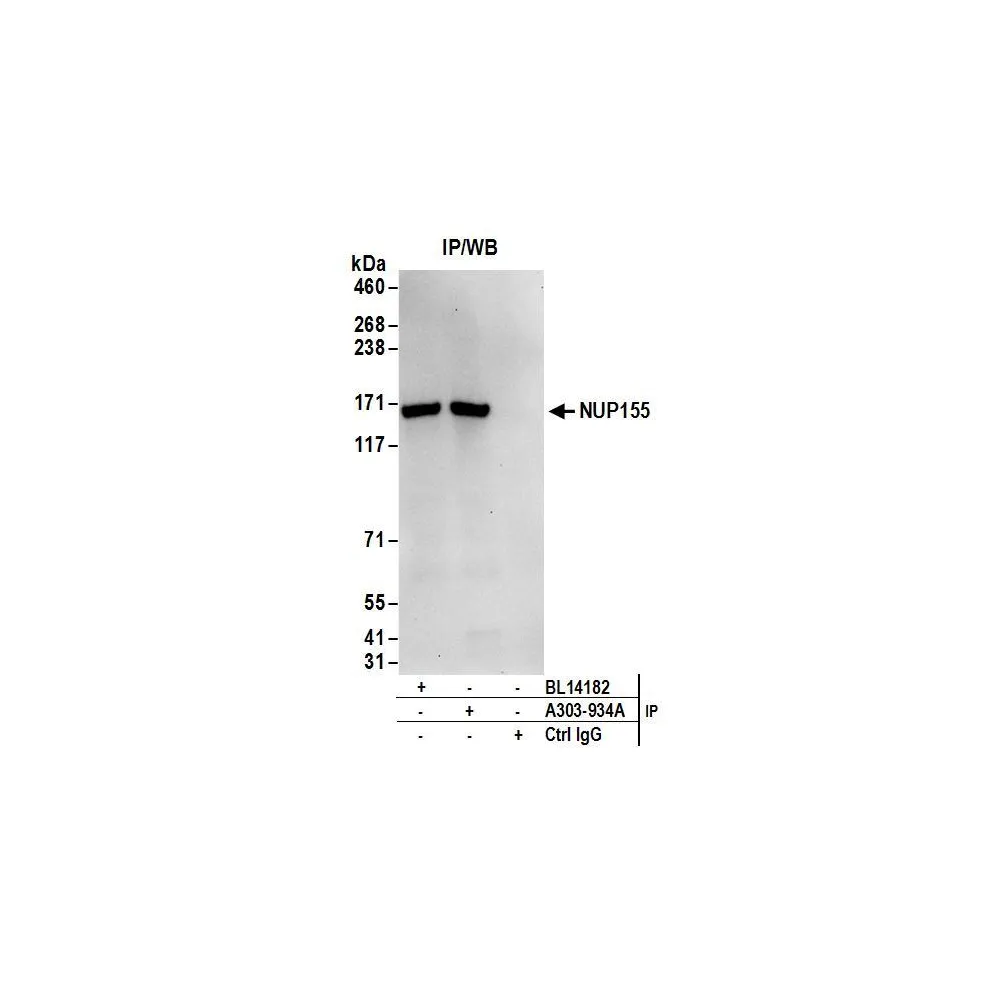 Rabbit anti-NUP155 Antibody, Affinity Purified