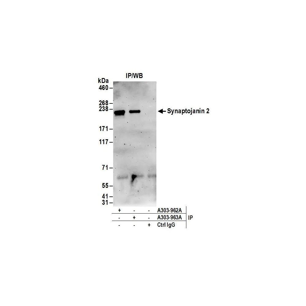 Rabbit anti-Synaptojanin 2 Antibody, Affinity Purified