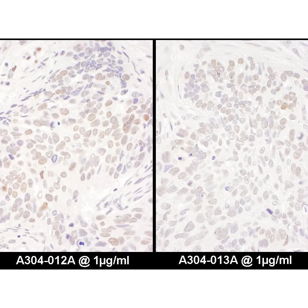 Rabbit anti-DENTT Antibody, Affinity Purified