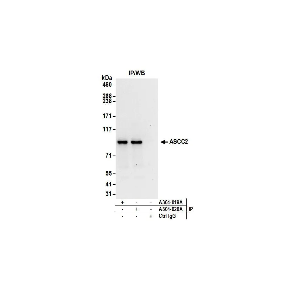 Rabbit anti-ASCC2 Antibody, Affinity Purified
