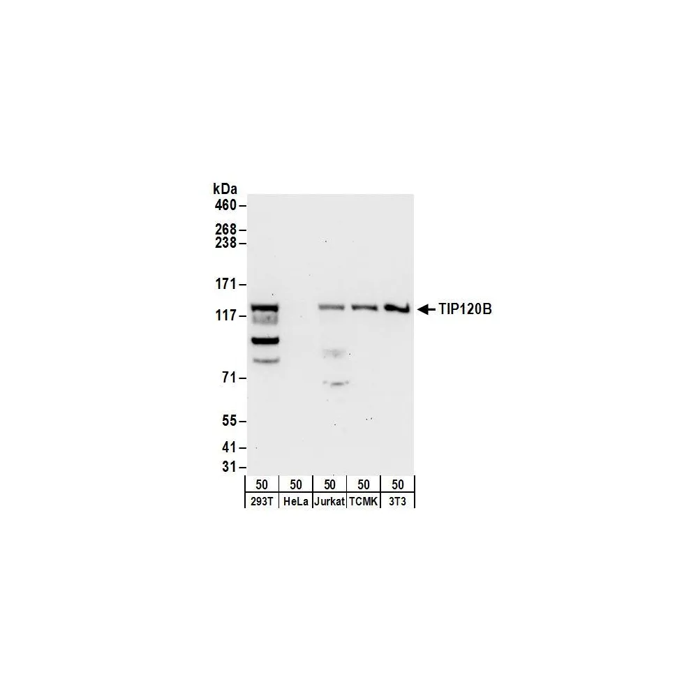 Rabbit anti-TIP120B Antibody, Affinity Purified