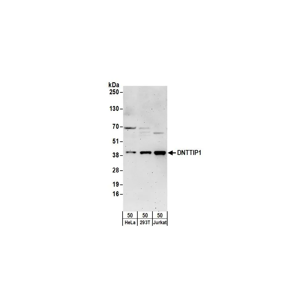 Rabbit anti-DNTTIP1 Antibody, Affinity Purified