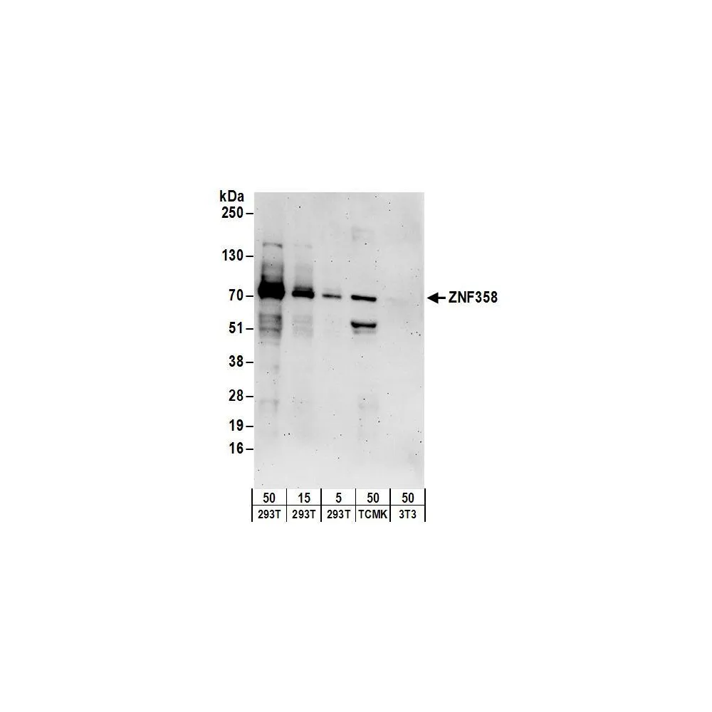 Rabbit anti-ZNF358 Antibody, Affinity Purified