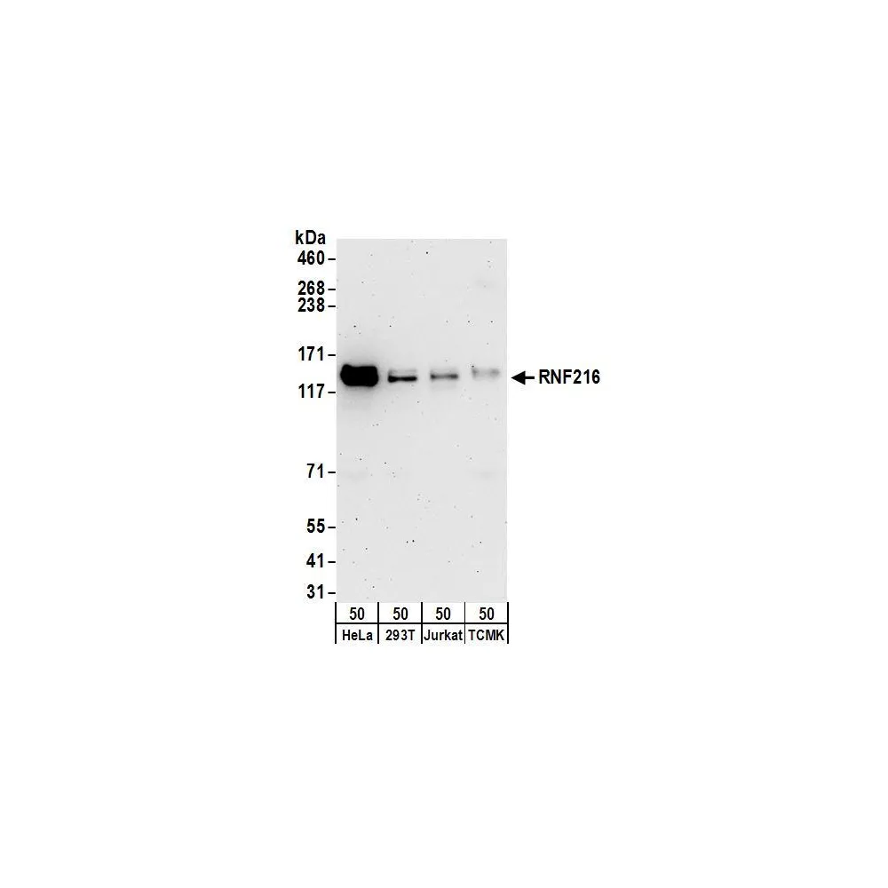 Rabbit anti-RNF216 Antibody, Affinity Purified