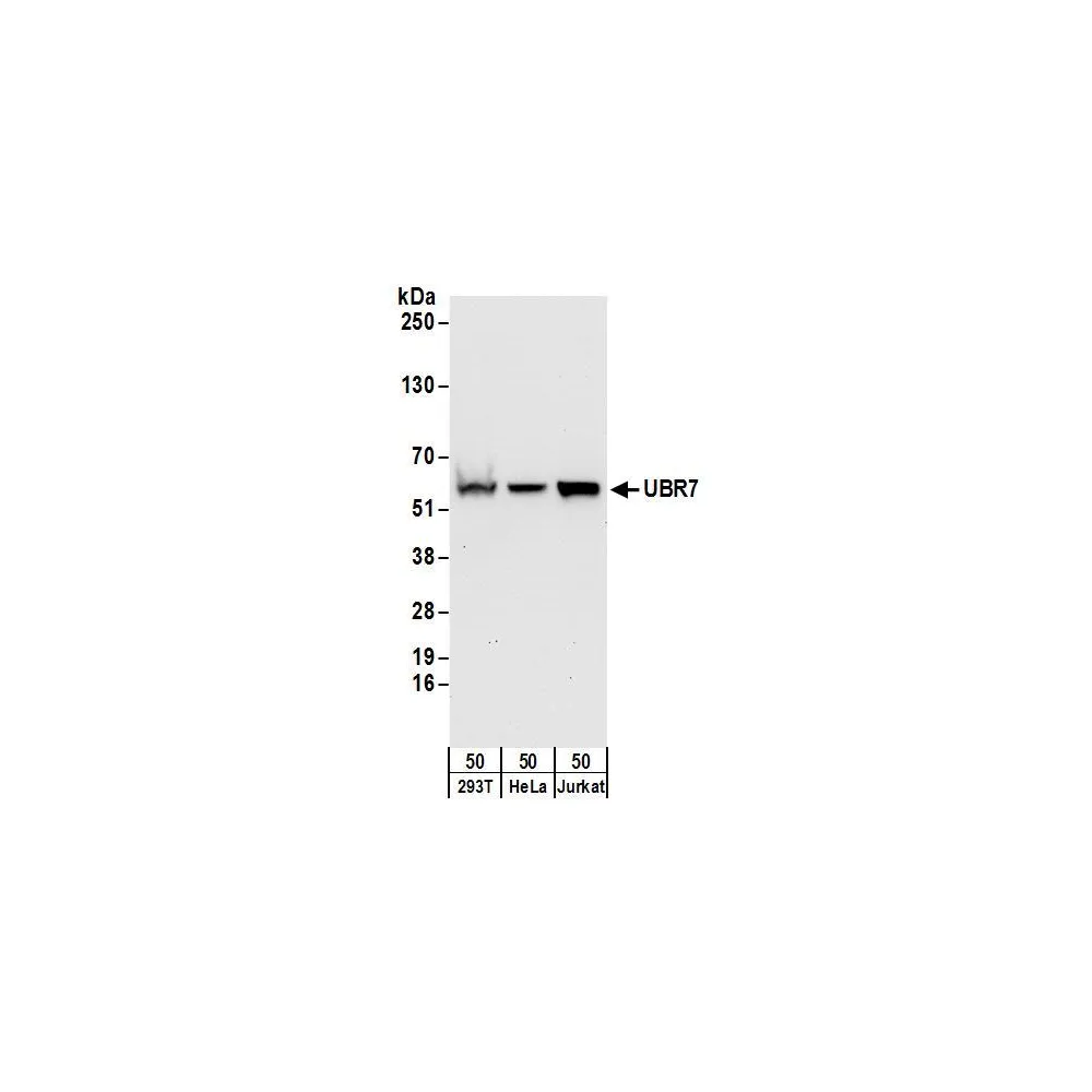 Rabbit anti-UBR7 Antibody, Affinity Purified