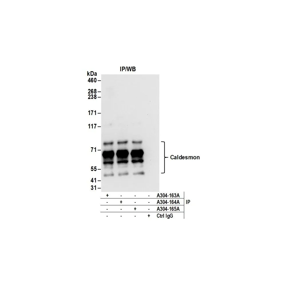 Rabbit anti-Caldesmon Antibody, Affinity Purified