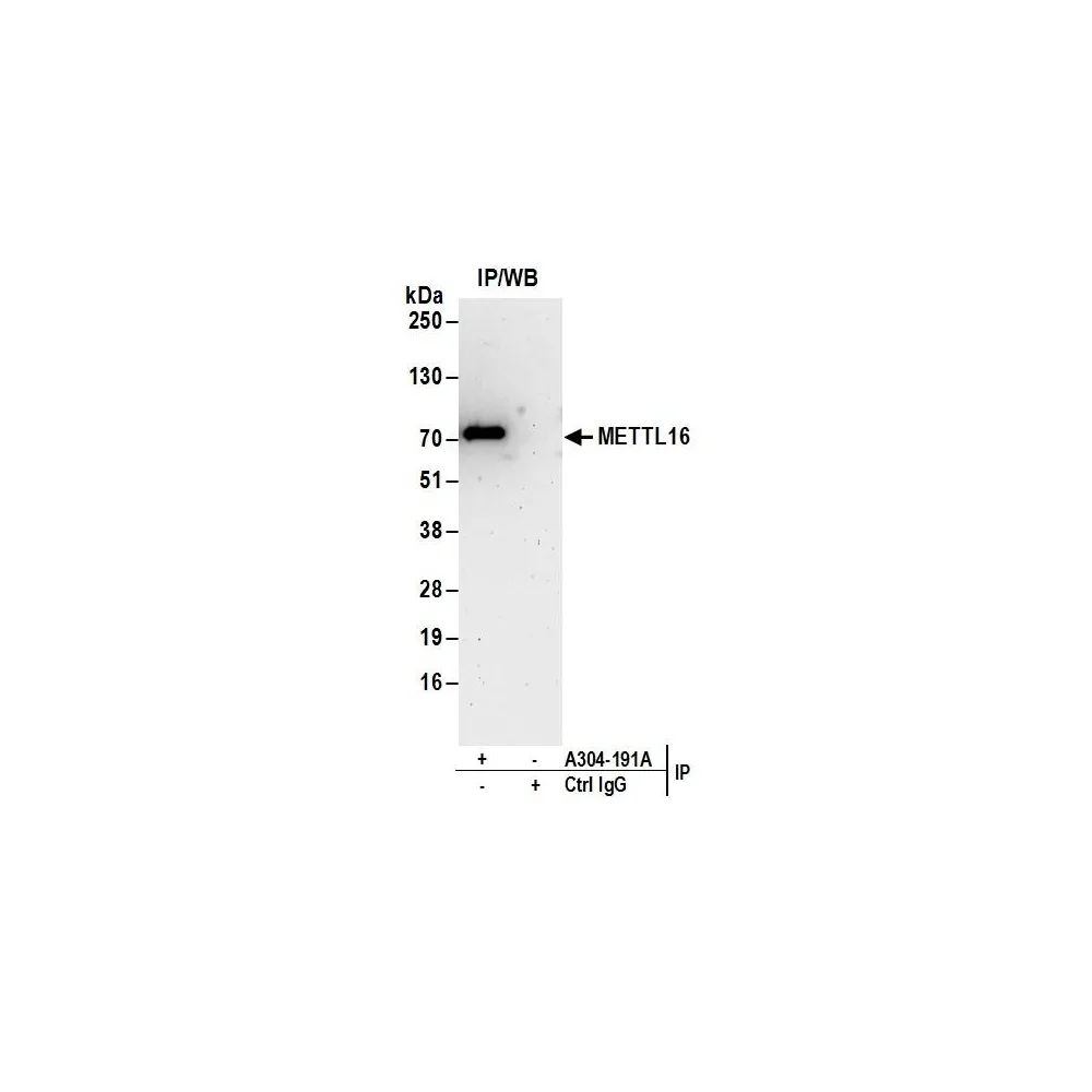Rabbit anti-METTL16 Antibody, Affinity Purified