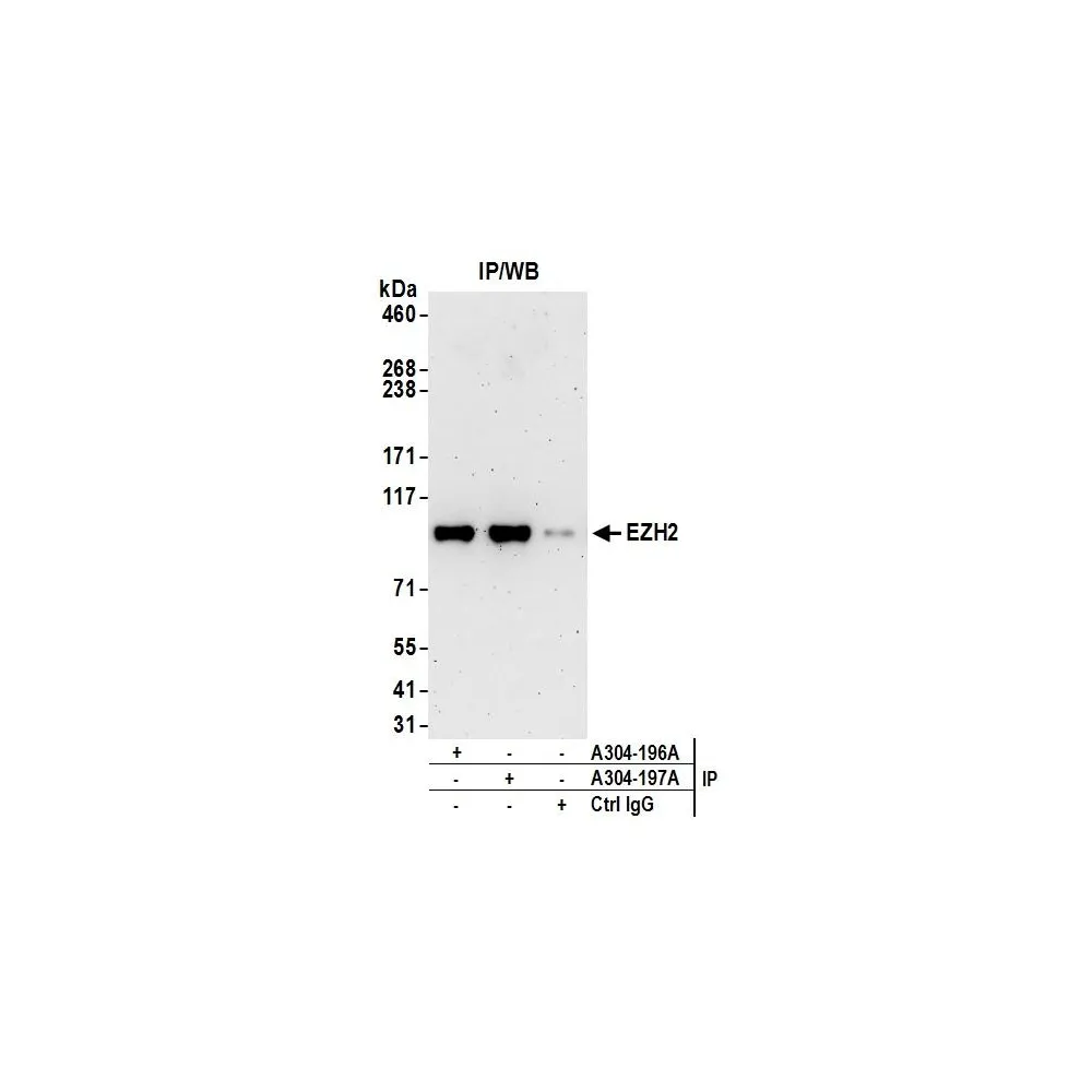 Rabbit anti-EZH2 Antibody, Affinity Purified