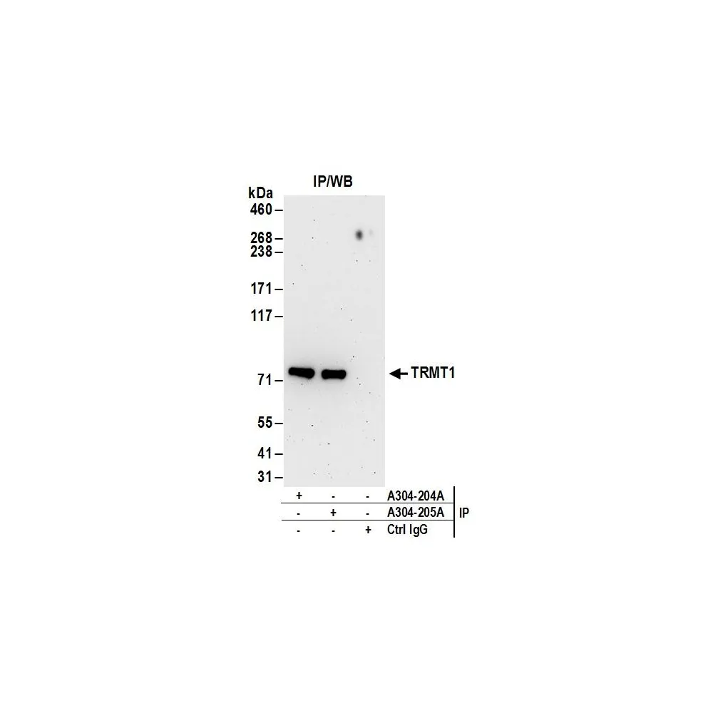 Rabbit anti-TRMT1 Antibody, Affinity Purified