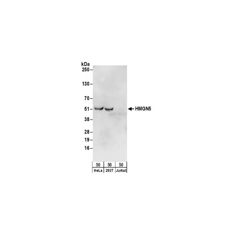 Rabbit anti-HMGN5 Antibody, Affinity Purified