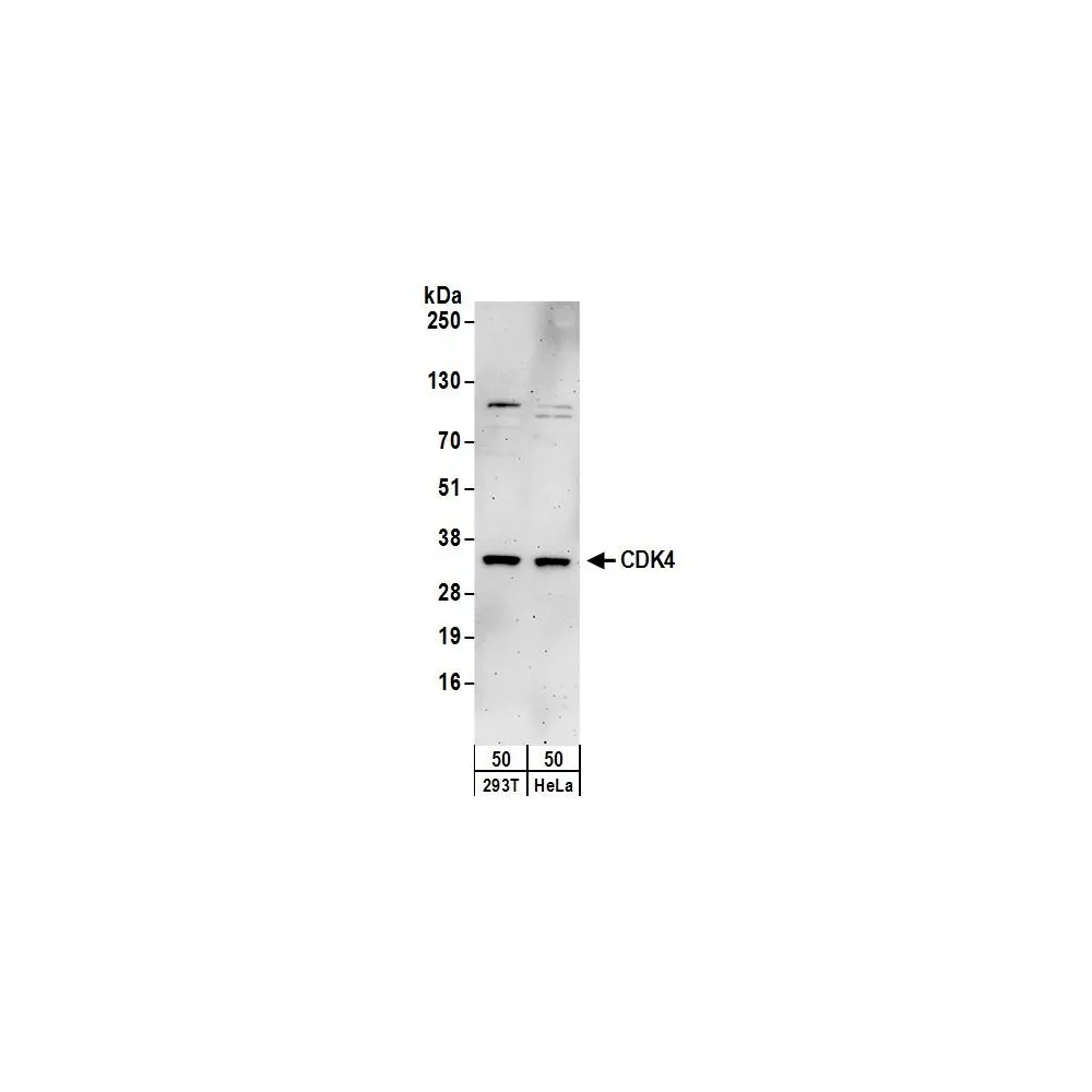 Rabbit anti-CDK4 Antibody, Affinity Purified