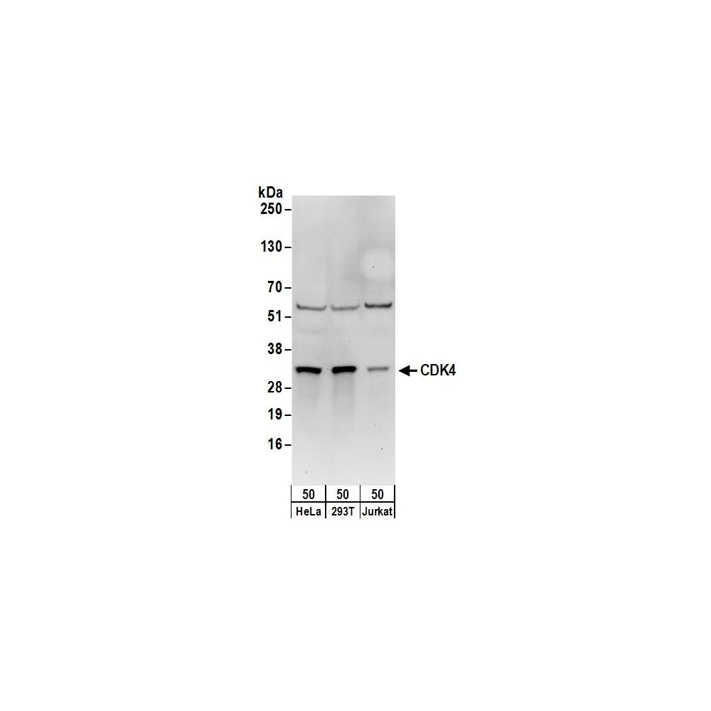 Rabbit anti-CDK4 Antibody, Affinity Purified