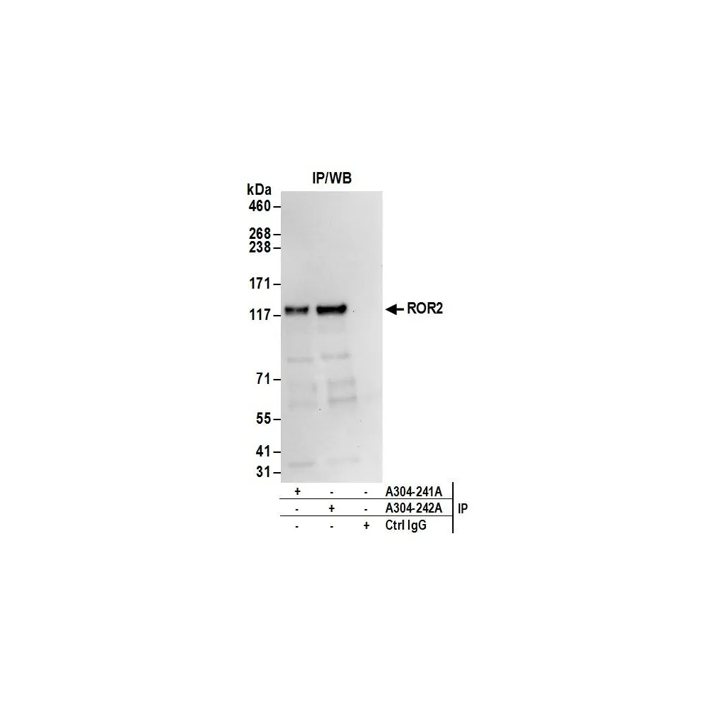Rabbit anti-ROR2 Antibody, Affinity Purified