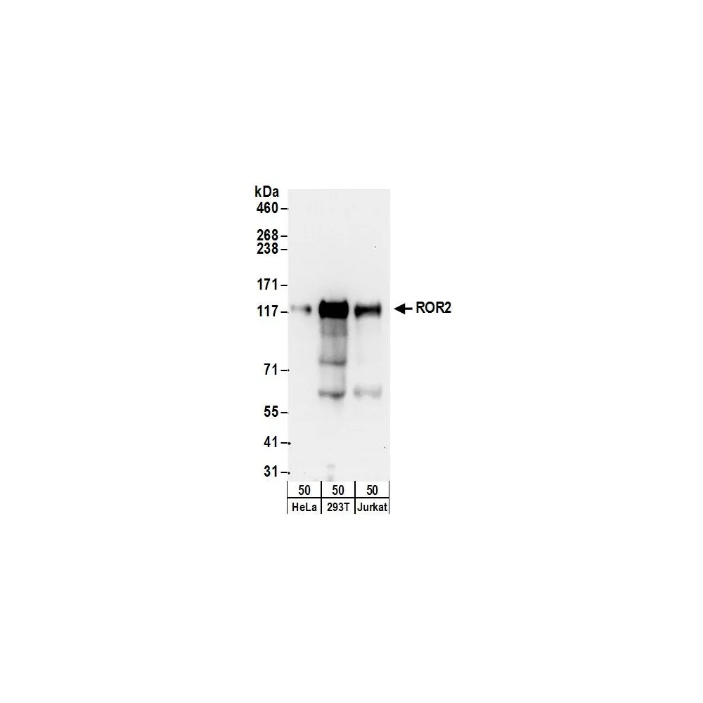 Rabbit anti-ROR2 Antibody, Affinity Purified
