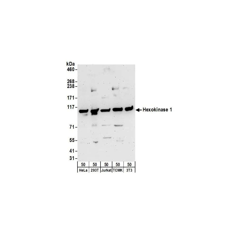 Rabbit anti-Hexokinase 1 Antibody, Affinity Purified