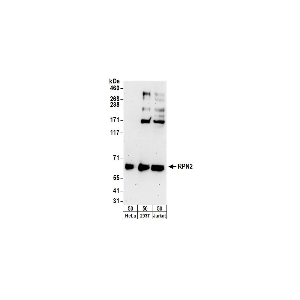 Rabbit anti-RPN2 Antibody, Affinity Purified