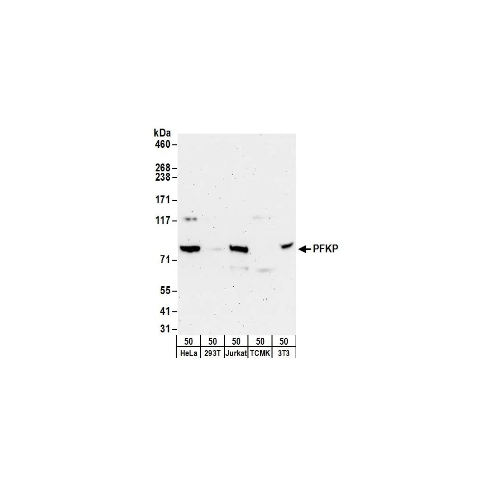 Rabbit anti-PFKP Antibody, Affinity Purified