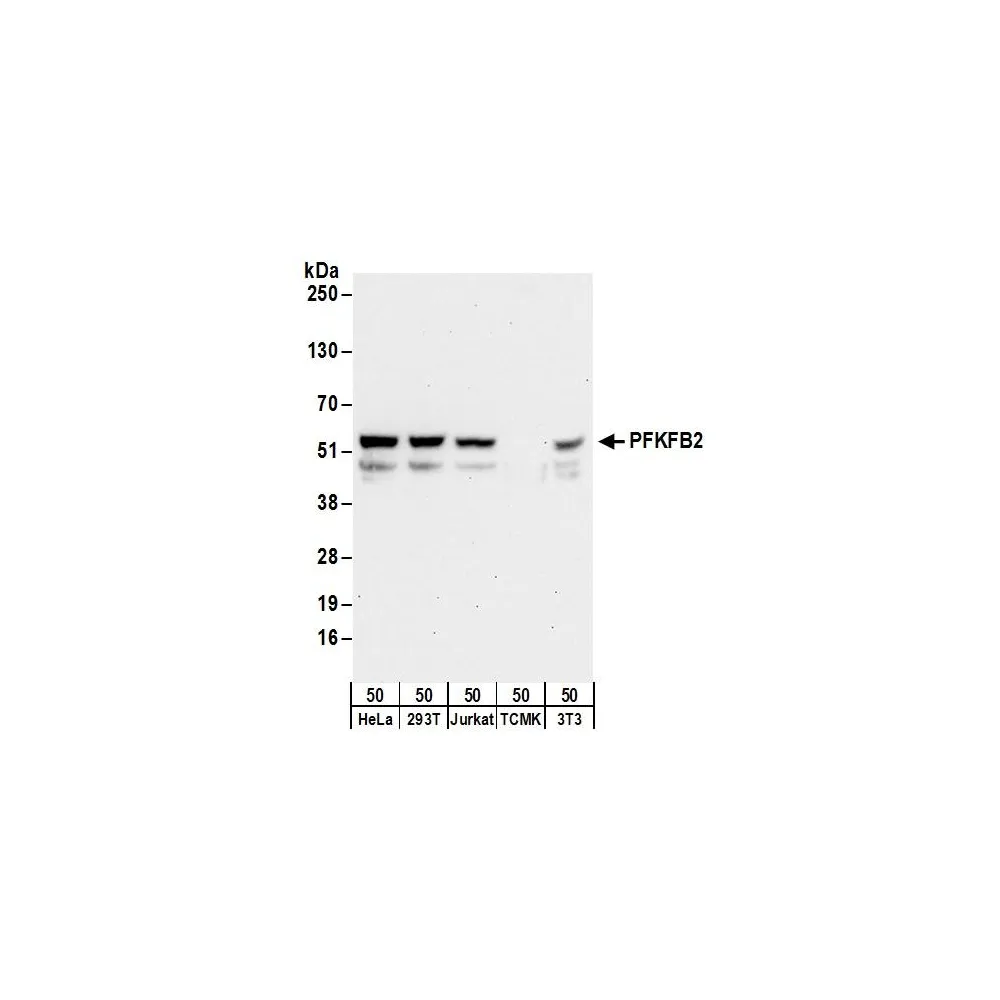 Rabbit anti-PFKFB2 Antibody, Affinity Purified