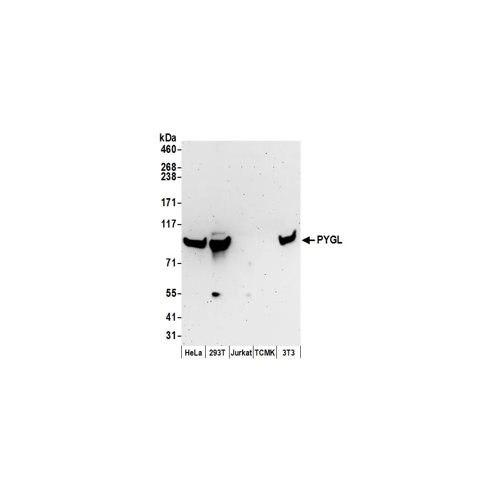 Rabbit anti-PYGL Antibody, Affinity Purified