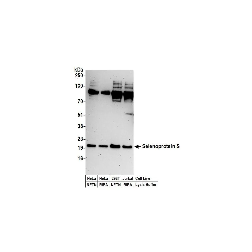 Rabbit anti-Selenoprotein S Antibody, Affinity Purified