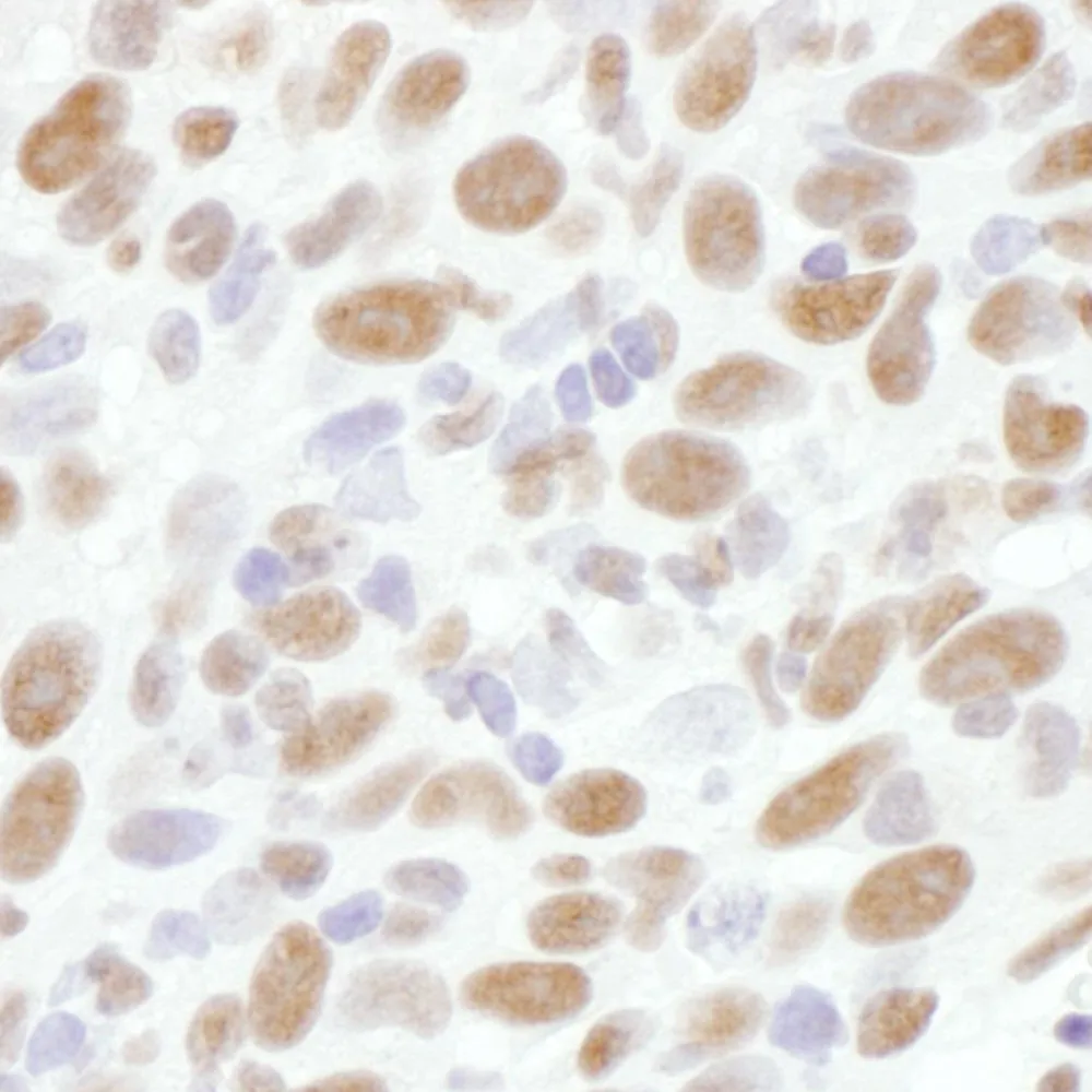 Rabbit anti-RNA Polymerase II, Phospho (S2) Antibody, Affinity Purified