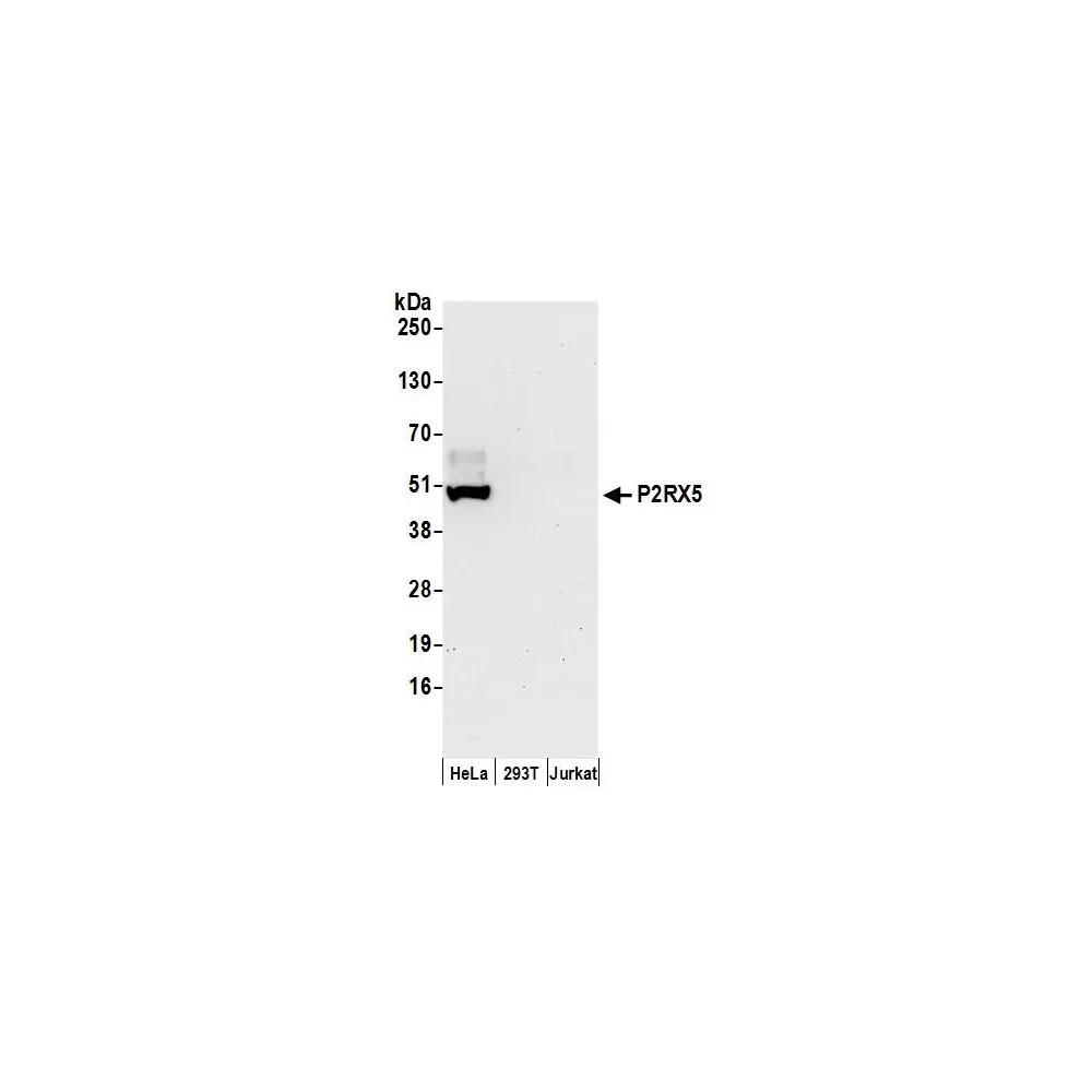 Rabbit anti-P2RX5 Antibody, Affinity Purified