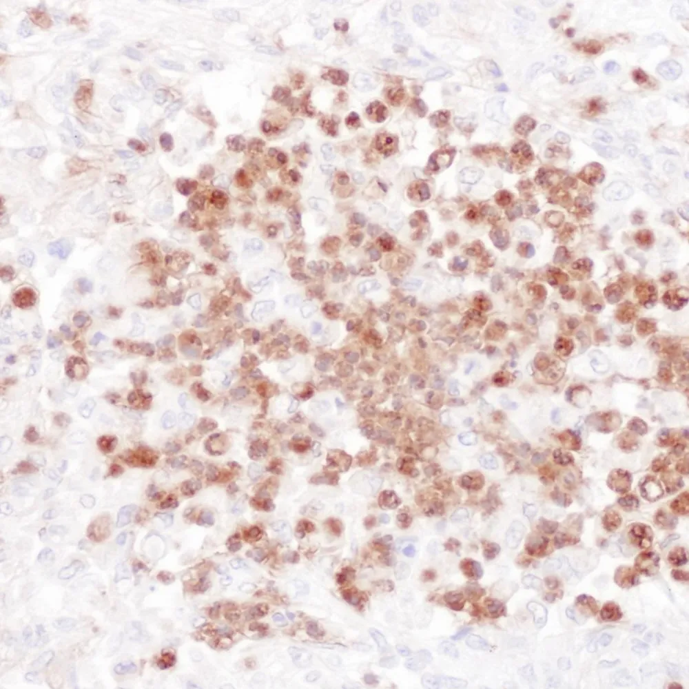 Rabbit anti-Stomatin Antibody, Affinity Purified