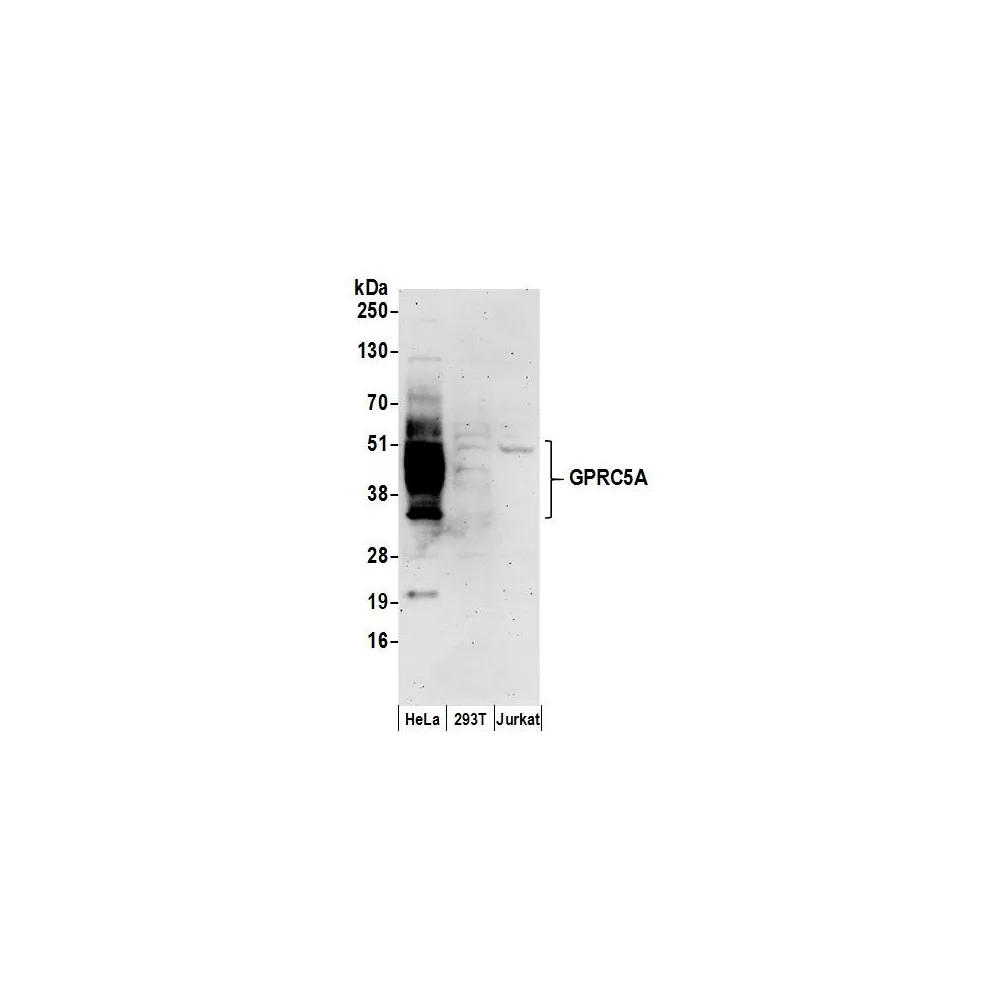 Rabbit anti-GPRC5A Antibody, Affinity Purified