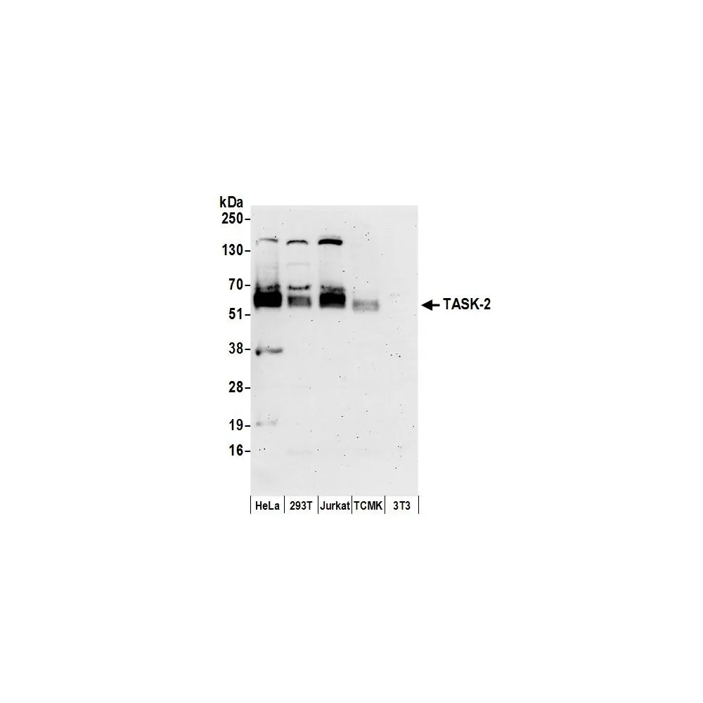 Rabbit anti-TASK-2 Antibody, Affinity Purified